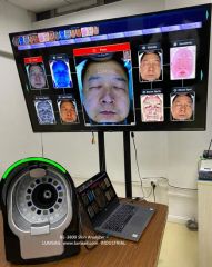 Skin Analyzer Machine Smart 3D Magic Mirror Face Scanner Skin Analysis System Acne Pigmentation Analysis - Image 3