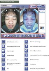 Portable 3D Skin Analyzer Skin Analysis Machine Face Scanner Skin Analyzer Set Skin Analyzer Software Portable Aesthetic Machines - Image 6