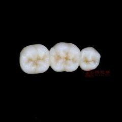 Customized Remote All Ceramic Teeth Supports Browsing Files in Various Formats Stl Ply Dcm Impression Model - Image 6