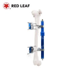Surgical Femur Fixation Device Orthopedic External Fixator for Thighbone Trauma Recovery - Jiangsu Rixin Medical Equipment Co., Ltd.
