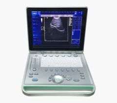C2 Color Doppler Ultrasound System - Image 4