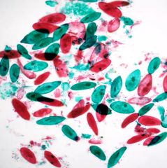 BestScope BS-2081L High Level LED Transmitted Illumination Research Biological Microscope - Image 6