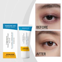 Vegan Retinol Under Eye Cream Collagen Peptides Anti-Aging Eye Cream for Dark Circles Puffiness Wrinkles Fine Lines Eye Cream - Image 5