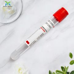 Medical Disposable Vacuum Blood Collection Tubes for Blood Routine Tests - Image 6