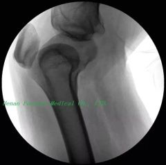 C-Arm Large Rotation System Trauma Surgery Digital X-ray Camera - Image 4