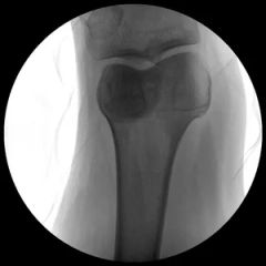 Stationary X-ray System LG-Plx118 High Frequency Digital Radiography System - Image 3
