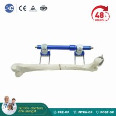 Xc Medico Orthopedic Medical Device Bone Fixation Tibia and Femur External Fixator - Image 1