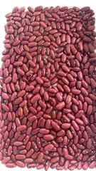 RED KIDNEY - SAINT FATIMA COMPANY