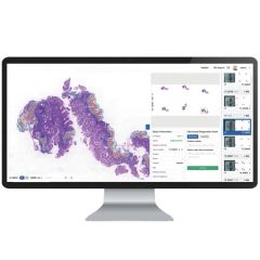 Pathology Ai System Medical Equipment Medical Instrument Group All Origin China Certification CE Trademark Gmedisys Application2 - Image 5