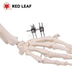 Surgical Fracture Instrument Mini Palm Orthopedic External Fixator Finger Universal Fixation - Jiangsu Rixin Medical Equipment Co., Ltd.