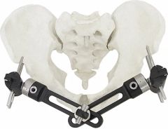 Adjustable External Fixator in White & Black, for Bone Fixation, Titanium Alloy - Image 3