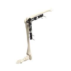 Surgical Instruments Orthopedic Fixation Pelvic External Fixator - Image 5