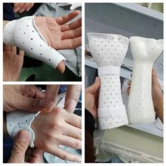 Orthopedic Thermoplastic Splinting Sheets Rehabilitation Fracture Bone Immobilization Material - Image 6