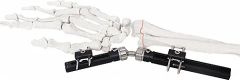 External Fixator for Bone Fixation, White & Black, Titanium Alloy Design - Image 1