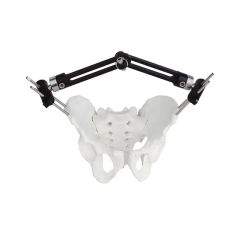 Surgical Instruments Orthopedic Fixation Pelvic External Fixator - Image 3