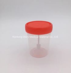 Premium Plastic Specimen Containers for Urine and Stool Samples - Image 1
