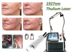 New Arrival Thulium Laser 1927nm Skin Acne Removal Melasma Removal Beauty Laser Equipment - Beijing DALI Beauty Technology CO., Ltd.
