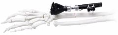 Adjustable External Fixator in White & Black, for Bone Fixation, Titanium Alloy - Image 5