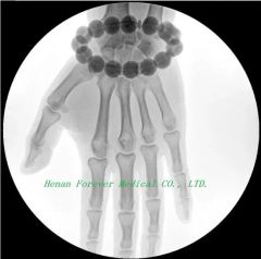 C-Arm Large Rotation System Trauma Surgery Digital X-ray Camera - Image 5