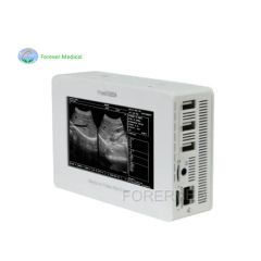 Portable HD 1080P Integrated Endoscope Camera Ent Unit HD Recorder - Image 2