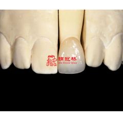Customized Remote All Ceramic Teeth Supports Browsing Files in Various Formats Stl Ply Dcm Impression Model - Image 2