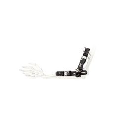 Surgical Instruments Orthopedic Fixation Pelvic External Fixator - Image 4