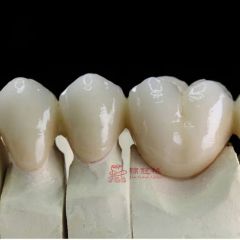 Customized Remote All Ceramic Teeth Supports Browsing Files in Various Formats Stl Ply Dcm Impression Model - Image 3
