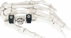 External Fixator for Bone Fixation, White & Black, Titanium Alloy Design - Image 3