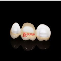 Customized Remote All Ceramic Teeth Supports Browsing Files in Various Formats Stl Ply Dcm Impression Model - Image 4