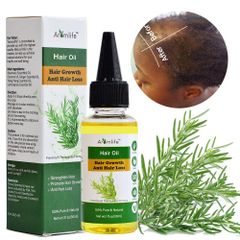 Chinaherbs oil hair growth fast for indian black women ginger hair growth Essential Oils anti hair loss private label - Xi'an Chinaherbs Commerce Co., Ltd.