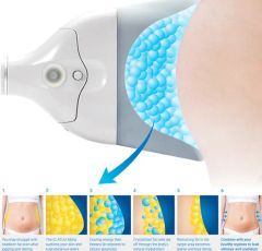 360 Cryolipolysis Body Slimming Machine with CE Approved - Image 4