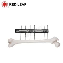 Orthopedic Correct Deformities Fixation Limbs Fracture Bone Transport a Type External Fixator - Jiangsu Rixin Medical Equipment Co., Ltd.