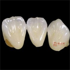 Customized Remote All Ceramic Teeth Supports Browsing Files in Various Formats Stl Ply Dcm Impression Model - Image 5