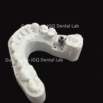Dental Products Suppliers Customized Titanium Base and Fixed Zirconia Dentures Supported for Dental Implant - Guangzhou Jinguanqiao Industry Co., Ltd. - China