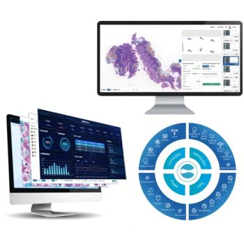 Pathology Ai System Medical Equipment Medical Instrument Group All Origin China Certification CE Trademark Gmedisys Application2 - Guangzhou Medisys Technology Co., Ltd. - China