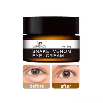 Hot Sale Private Label Instant Anti Wrinkle Eye Bags and Dark Circle Removal Eye Cream for Eyes Care - Shantou Una Cosmetics Co., Ltd - China