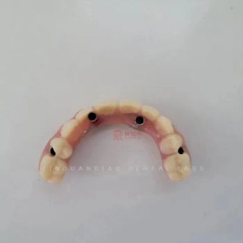 Removable Immediate Dentures Supported for Dental Implant Use Home Origin China Kind Dentures HS Code 9021210000 Certificates - Guangzhou Jinguanqiao Industry Co., Ltd. - China