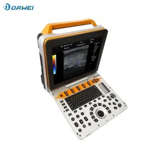 High Quality 4D Color Doppler Dwp60 Ultrasound Diagnostic Scanner - Dawei Medical Co., Ltd - China