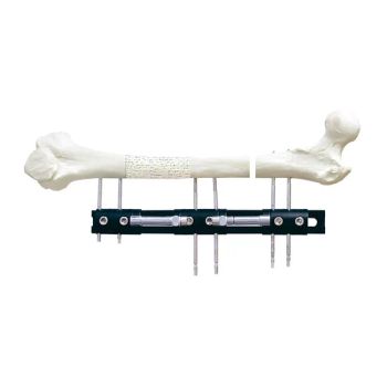 Tibial External Fixator for Tibial Fracture Fixation Orthopedic Implants - Euro-Tek Industrial Co., Ltd. - China