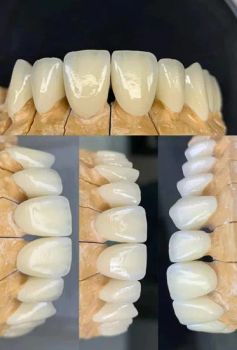 Zirconia Block for Veneers Teeth Other Dental Equipment Zirconia - Qinhuangdao Silide Ceramic Technology Co., Ltd. - China