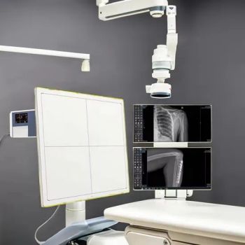 Hospital Medical Diagnostic Radiography Equipment X-ray Dr Flat Panel Detector Wireless Reusable Software with Multi-Language Support - Guangzhou Umy Medical Equipment Co., Ltd. - China