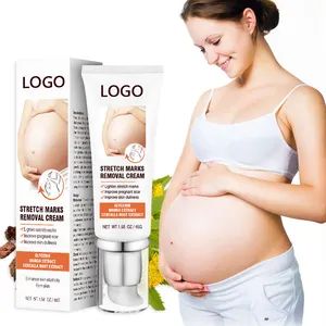 OEM Pregnancy Scar Care Cream - a Gentle Cream for Smoothing and Nourishing The Skin, Effectively Reducing Pregnancy Scars on The Body - Shandong Shiyi Trading Co., Ltd. - China