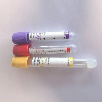 Reliable Chinese Supplier for Medical Vacuum Blood Test Tubes - Suzhou Lingyan Medical Technology Co., Ltd. - China
