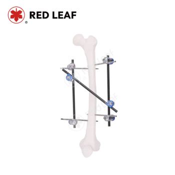 Premium Orthopedic Femoral Shaft Medical Fixator Bone Fracture Surgical External Fixation - Jiangsu Rixin Medical Equipment Co., Ltd. - China