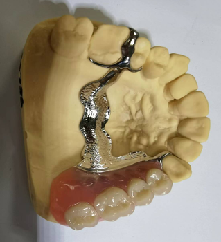 3D Printing China Dental Lab Price Customize Gold Titanium Metal Crown - Shenzhen Myy Dental Technology Co., Ltd. - China