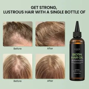 Natural Organic Vegan Scalp Hair Serum Anti Hair Loss Thickening Argan Oil Biotin Hair Growth Oil for Men - GUANGZHOU BANGTING COSMETICS CO., LTD. - China
