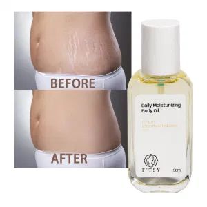 Natural Skin Whitening Moisturizing Pregnancy Skin Repair Tightening Stretch Marks OEM Skincare Oil - Guangzhou Shiruoni Cosmetics Co., Ltd. - China