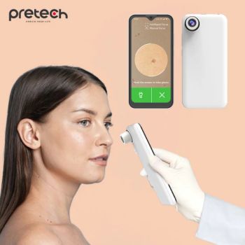 OEM Smartphones Unlocked Cell Phones Smartphones Mt6739 5 Inch Android Smartphone with 4X/60X Magnify Lens Skin Care Device - Shenzhen Pretech Industrial Co., Ltd. - China