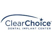 Product - ClearChoice Dental Implant Center - United States