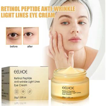 30g Eye Bag Removing Firming Wrinkle Eye Cream Moisturizing Reduce Fine Lines Retinol Eye Cream - Guangzhou Yami Beauty Technology Co., Ltd. - China